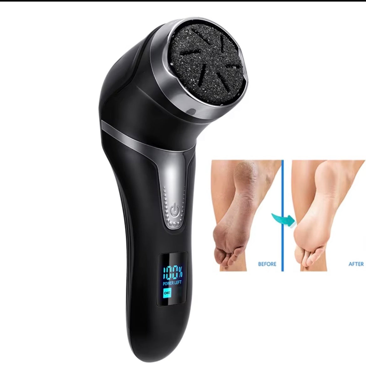 Removedor Elétrico de Calos Profissional – Pés Lisos em Minutos